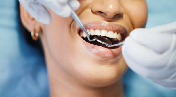 Best Knocked-Out Tooth Emergency  in Penn State Erie, PA